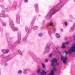 Fungal Reference Laboratory